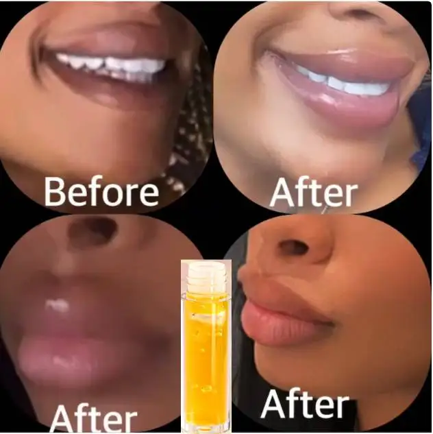 TURMERIC LEMON Lip Oil Dark Lips Remedy Lip Lightening Cream Balm for Lightening & Brightening Dark Lips Pink Cream