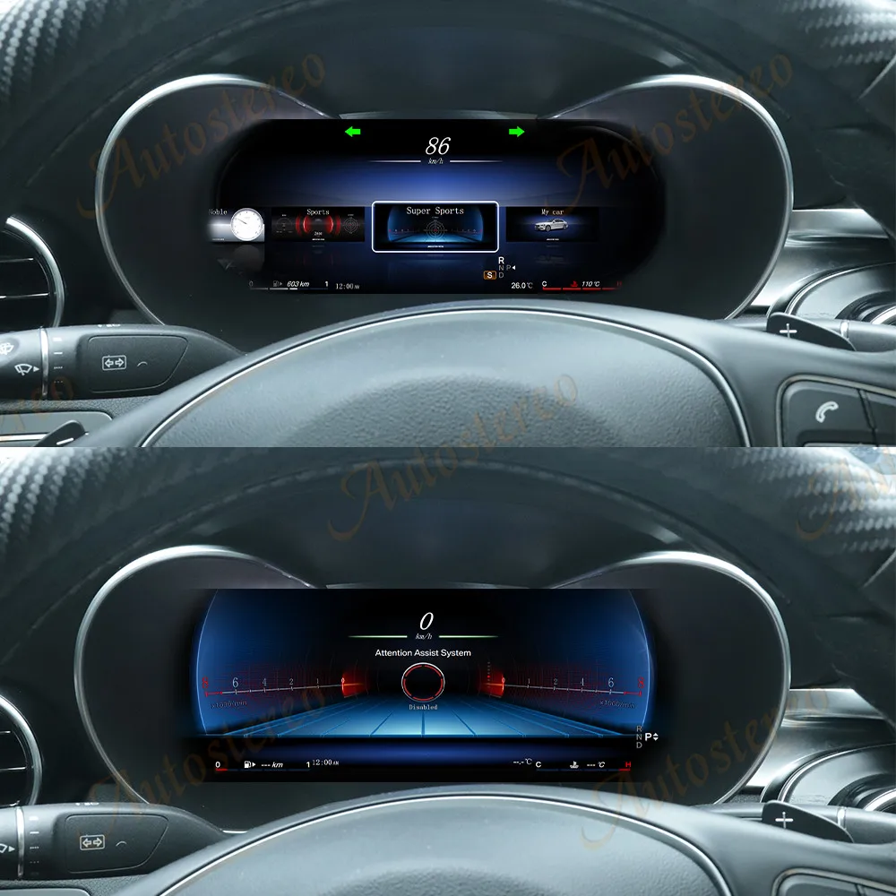 Car Digital Cluster Carplay Virtual Cockpit Screen For Mercedes Benz X Class W47