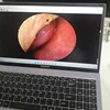 Ultra HD ENT Endoscope 2.7mm Human Body and Pet Support Laptop and TV with USB Interface to Use the Endoscope 6