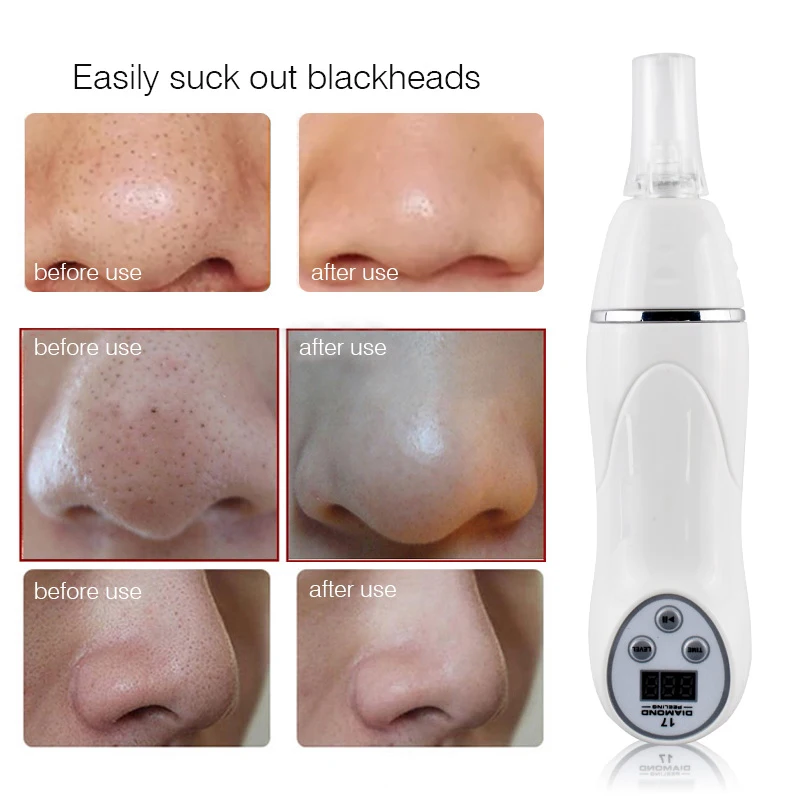 Micro Acne Remover Vacuum Massage Acne Removal Facial Smoothing Cleansing Skincare Drinding Diamond Pen home beauty equipment