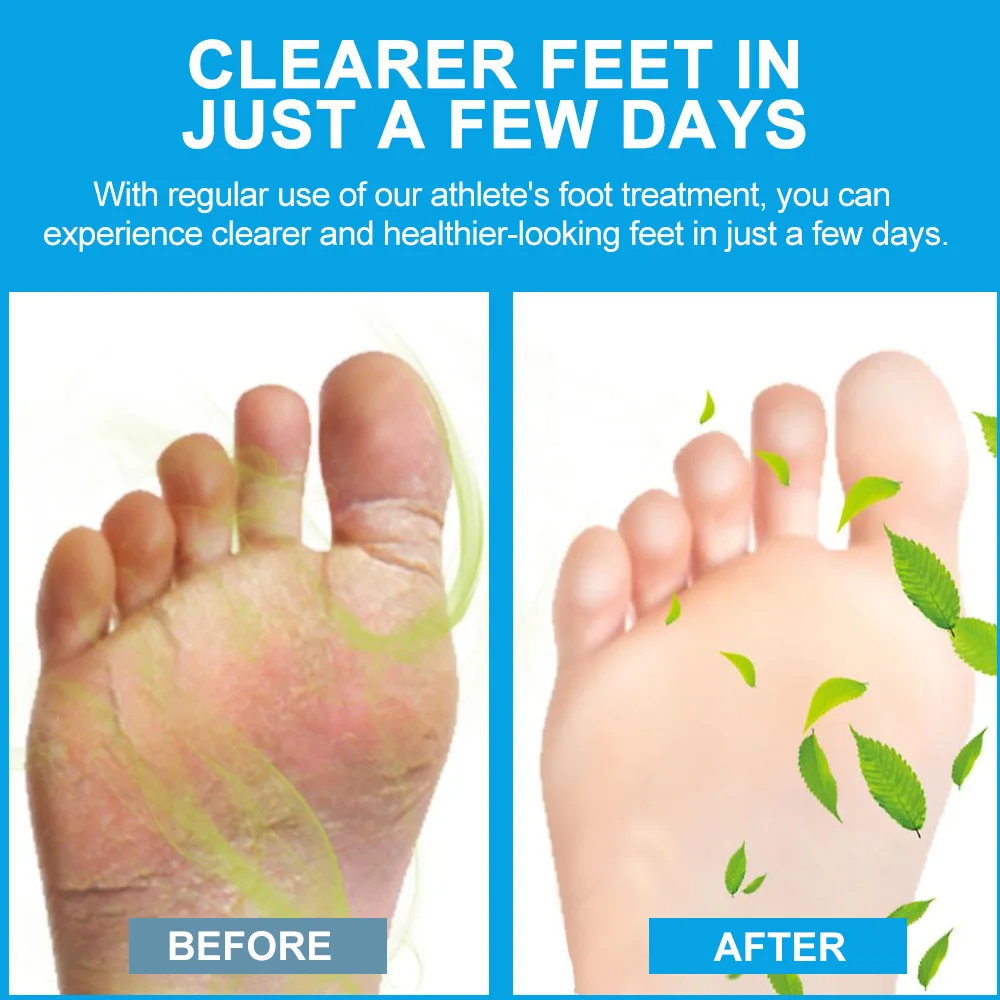 Foot,pedicure,exfoliante para pies pedicure,Tea tree oil and athlete's foot ointment, itchy and smelly feet