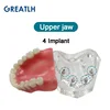 Dental Teeth Model with Implant Overdenture Inferior Demo Mandibular Model Dentist Student Learning Model 4