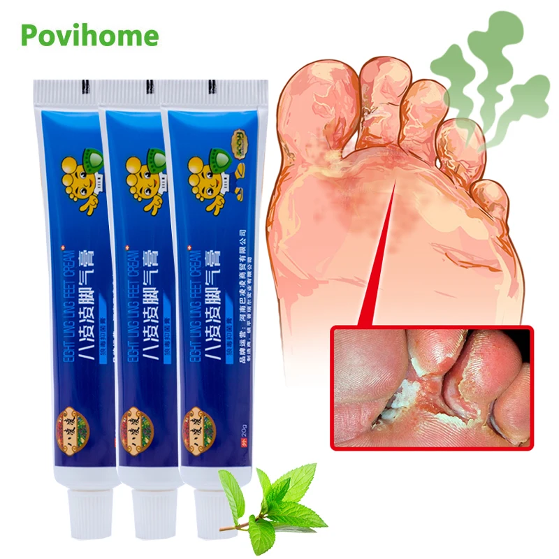 13PcsBeriberiAntibacterialCreamAthletesFootItchingAnti