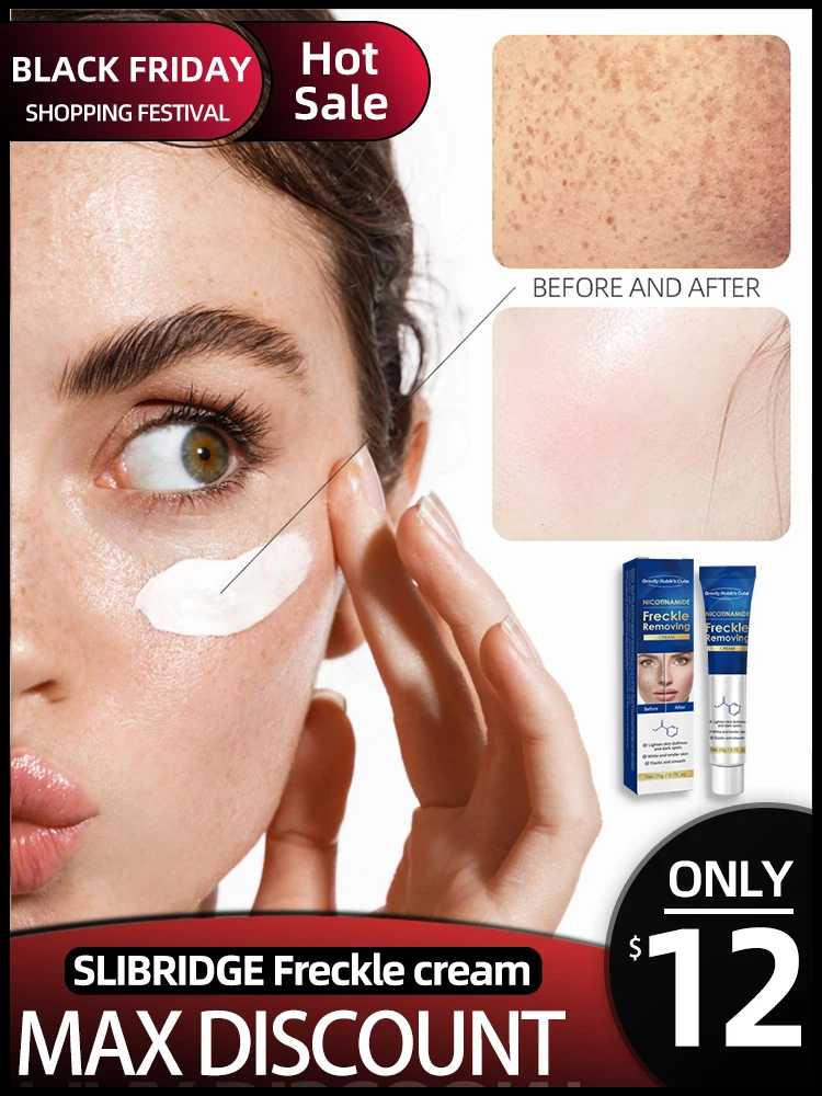 SLIBRIDGE freckle remover cream remove from pigmentation on the face