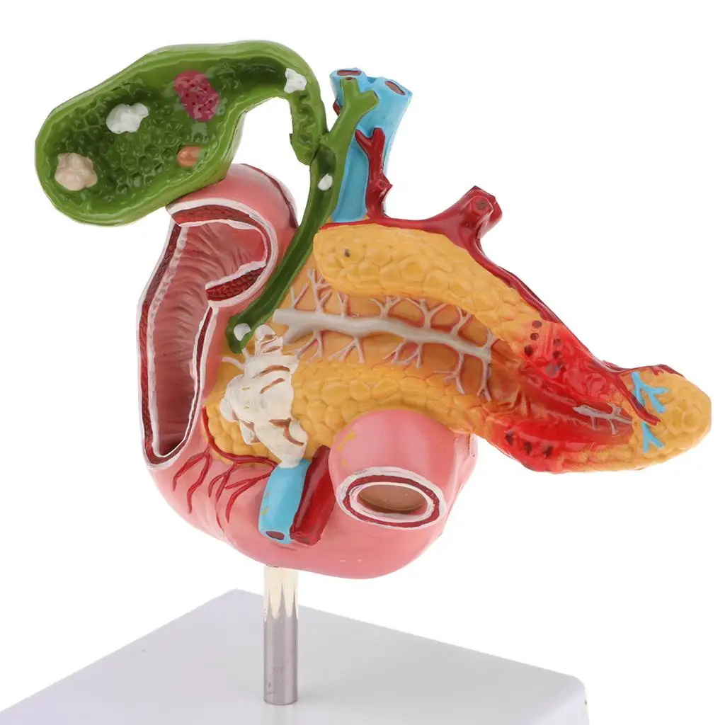 Lifesize Human Pancreas Duodenum Gallbladder Model with Vessels & Nerves, School Teaching Aid 5