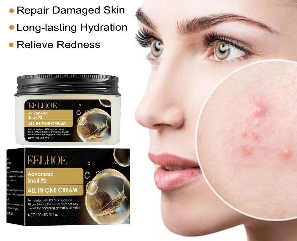 

Snail Liquid Acne Treatment Cream Pimples Scar Removal Facial Cream Oil Control Shrink Pores Skin Care Beauty Health