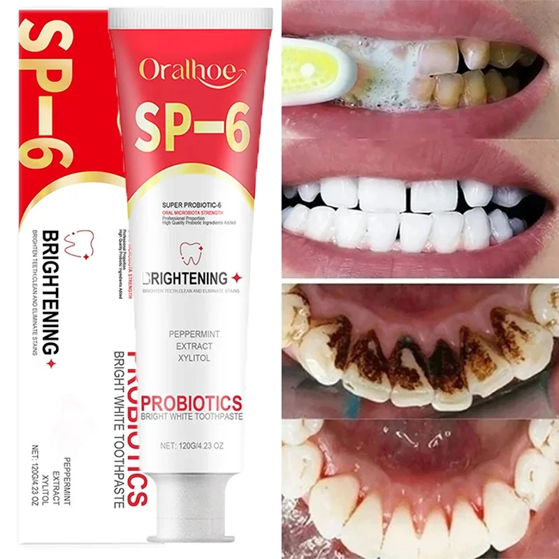 SP-6 Probiotic Toothpaste Whiten Clean Teeth Remove Stains Oral Care Management Fresh Breath With Sodium Saccharin Lactobacillus teeth whitening product teeth health product
