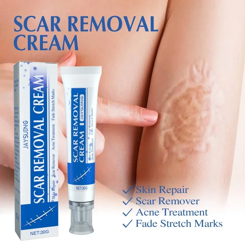 

Fade Scar Cream Fast Removal body Skin Scars Treat Surgery Scars Stretch Marks Acne Pox Prints Burn Repair Facial Care Gel