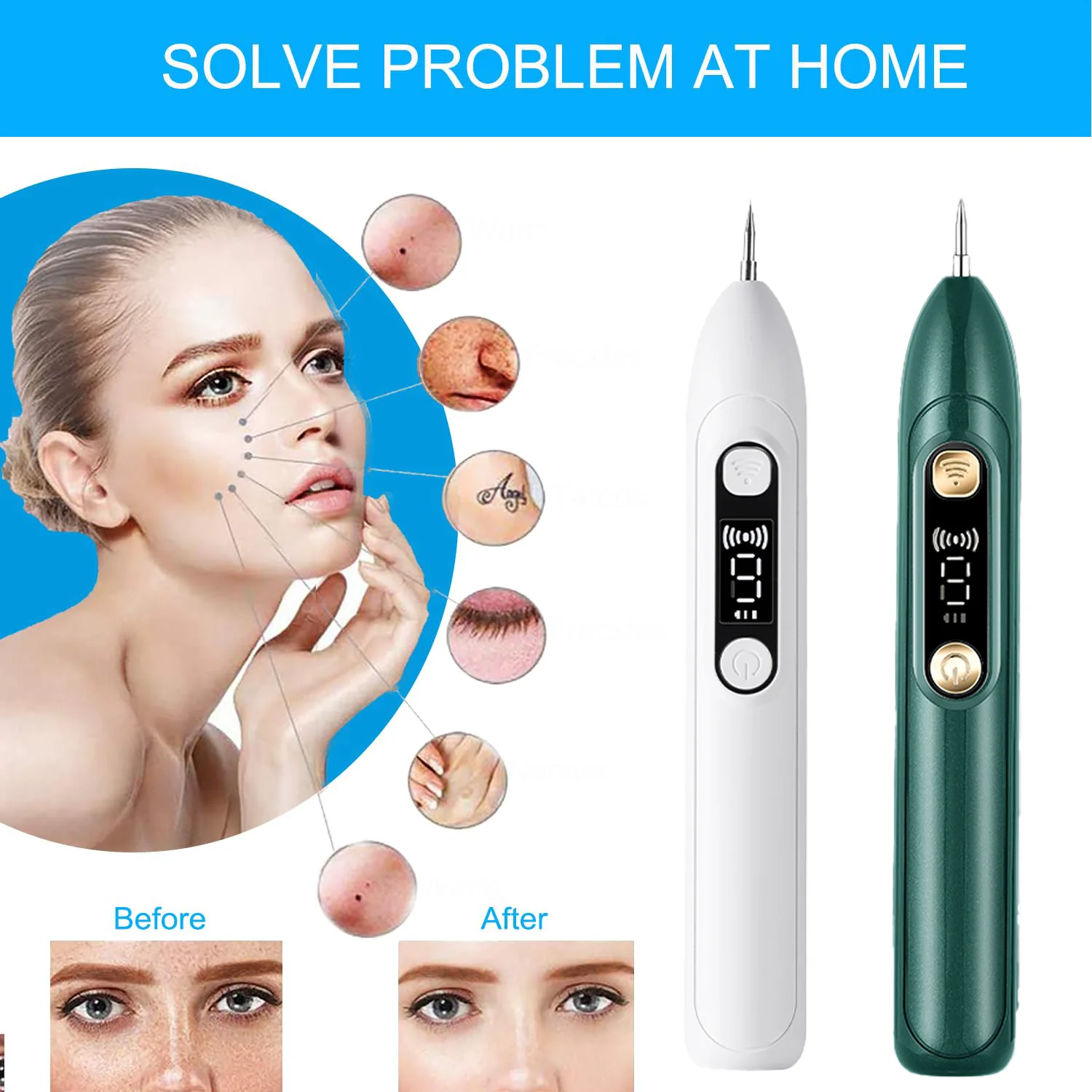

Mole removal skin tag removal pen