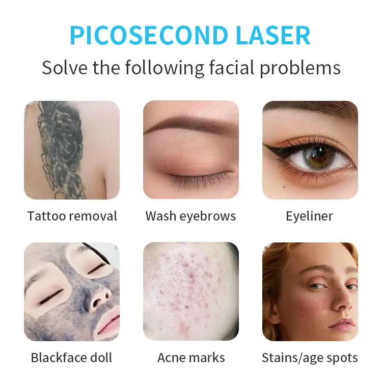 ND:YAG 1064NM Q-switch Pico Way Second Laser Tattoo Eyebrow Removal Machine Black Doll Skin Rejuvenation
