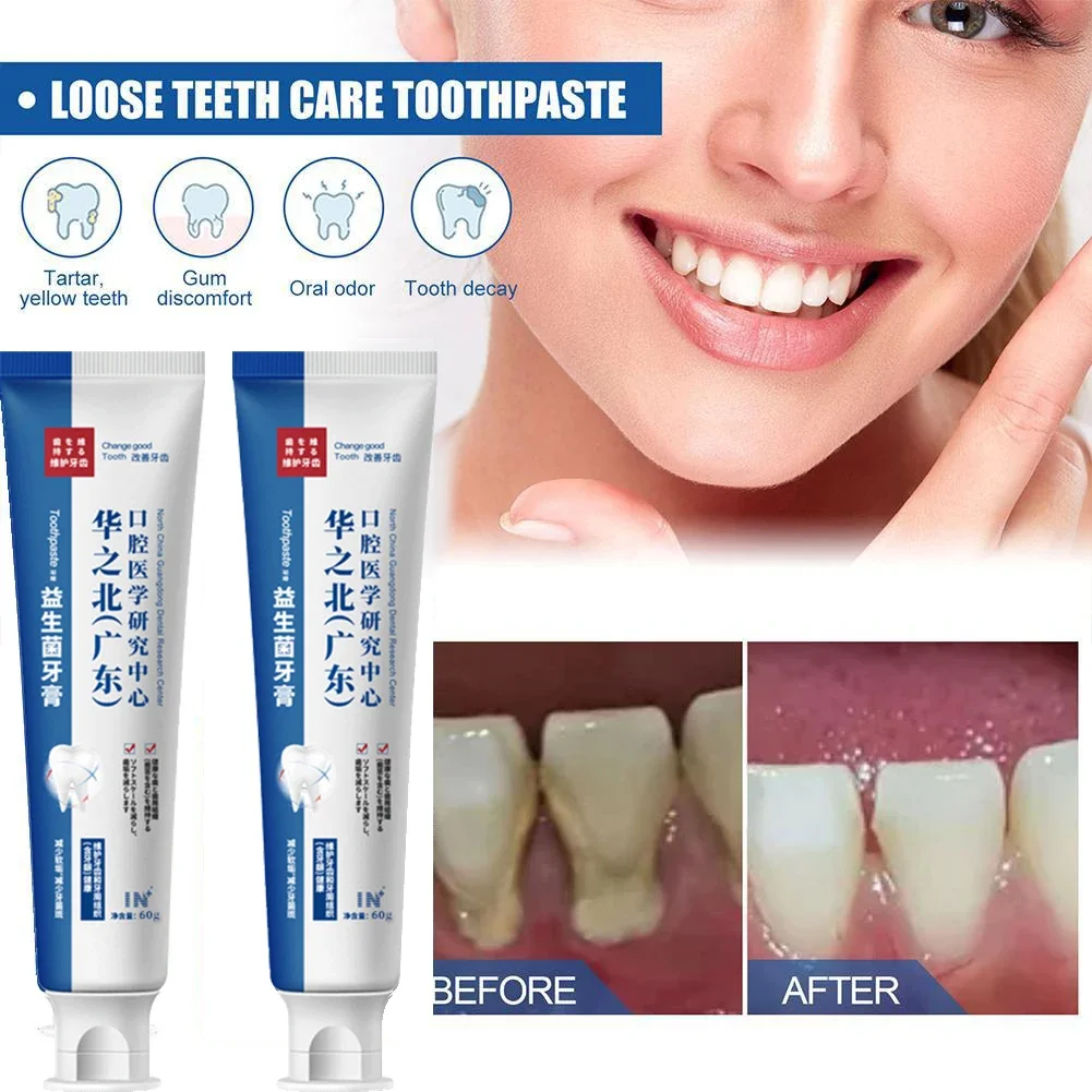 Quick Repair of Cavities Caries Removal of Plaque Stains Decay Whitening Yellowing Repair Teeth Teeth Whitening Oral Hygiene