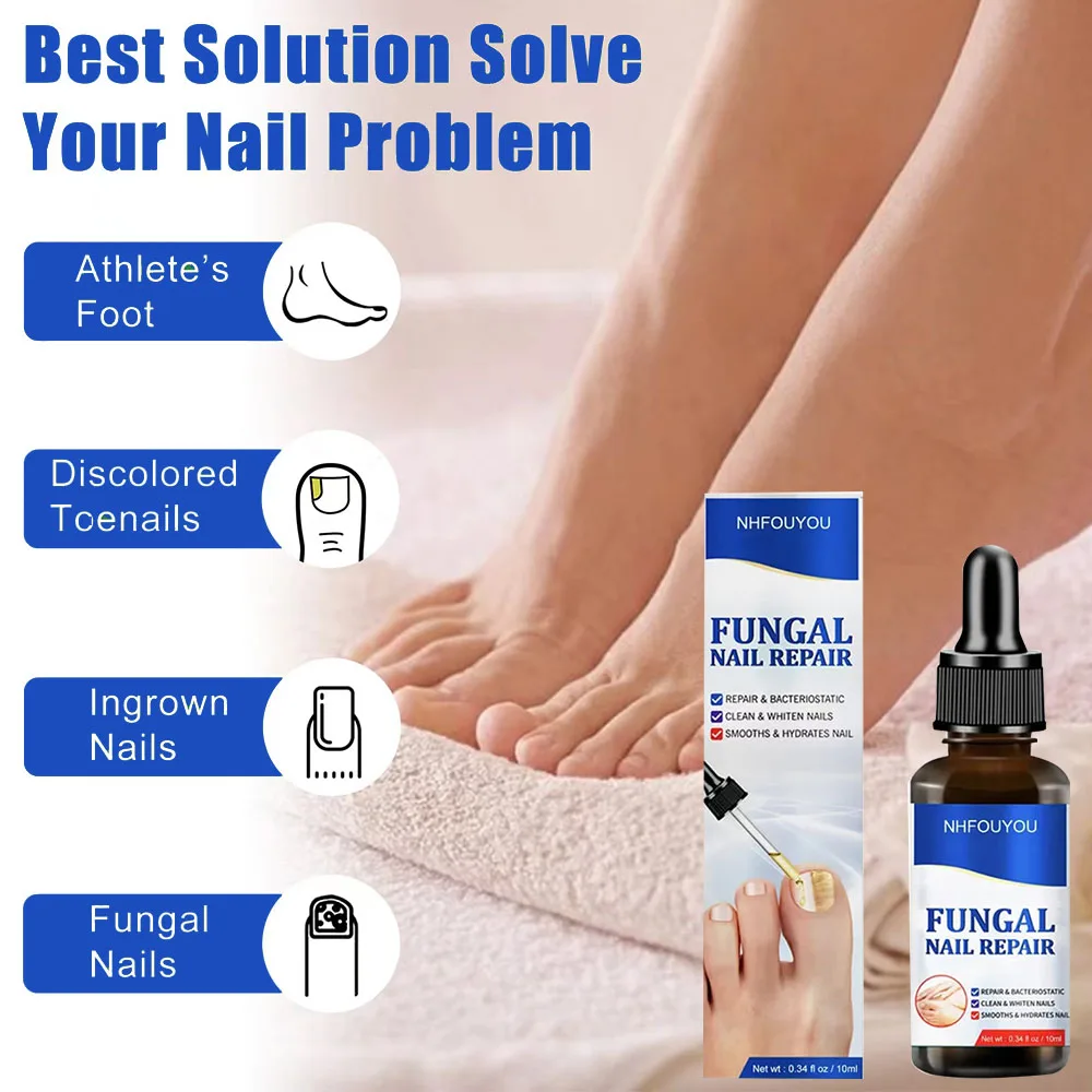 

Nail Fungus Treatment For Toenail Strength Nail Repair Solution Hydrates Nail Repair Renew Damaged Discolored Foot Toenails