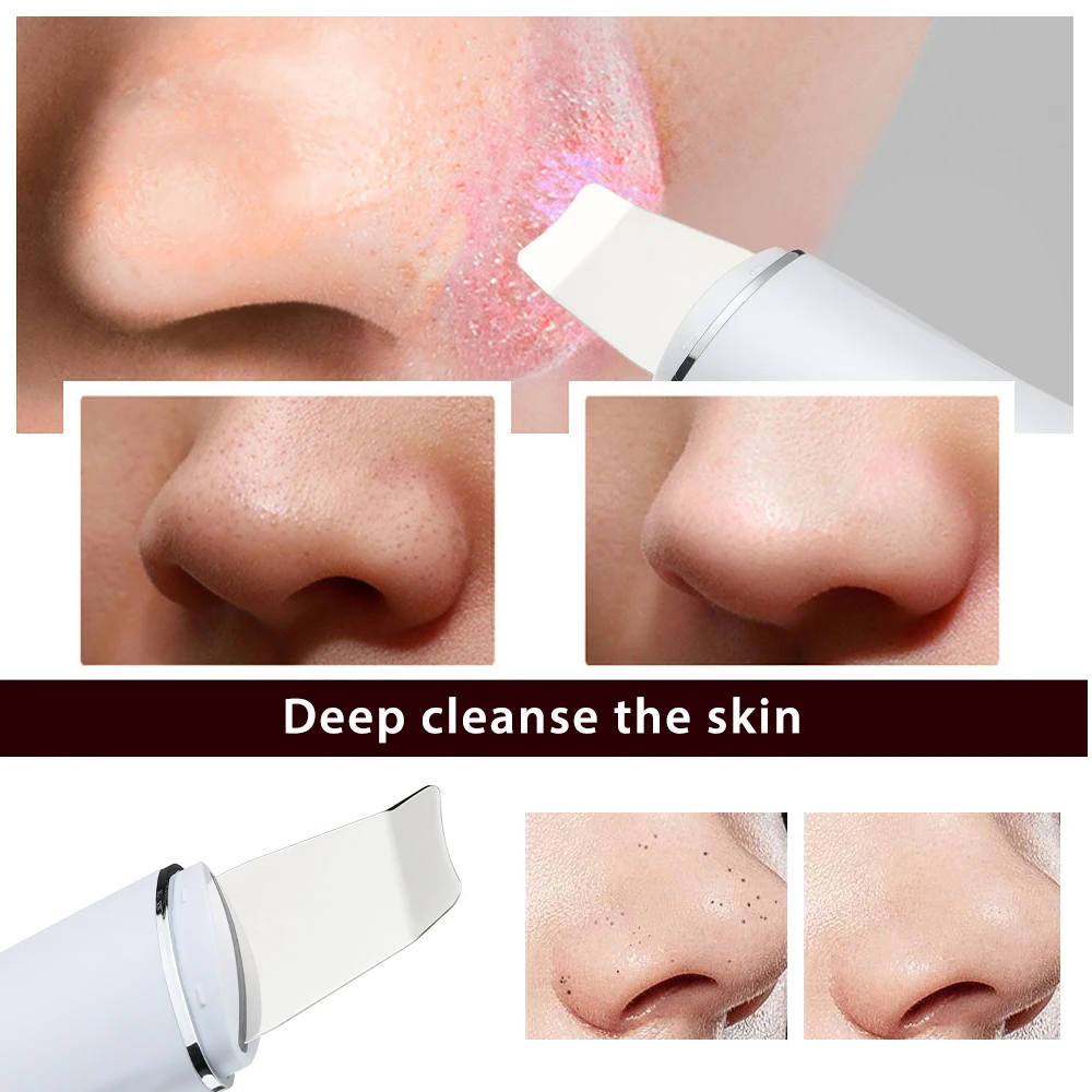Facial Scrubber Blackhead Remover Facial Cleaner Ultrasonic Scrubber Peeling Machine EMS Positive Negative Ion Blackhead Export Mask Imported Lifting Firming