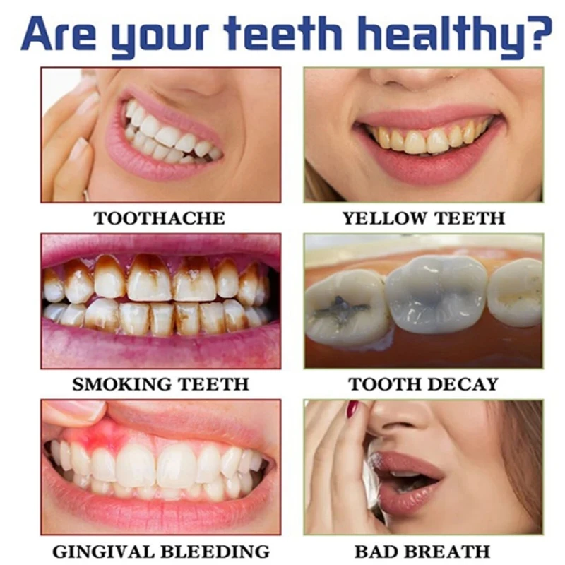 V34 Pro Smile Removal Plaque Stain Purple Corrector Teeth Whitening Toothpaste Enamel Care Easy Reduce Yellowing Oral Clean Care teeth whitening essence teeth whitening product