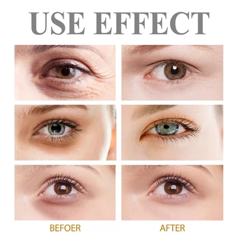 Instant Eye Bag Removal Cream Retinol Anti-Wrinkle Firming Skin Fade Fine Lines Anti Dark Circle Puffiness Brighten Eye Care Gel - Thumbnail 3