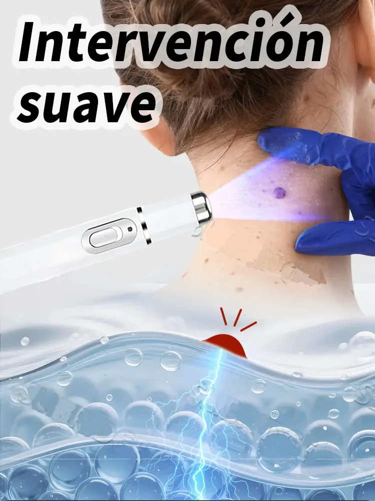 Wart Care Blue Light Pen 3