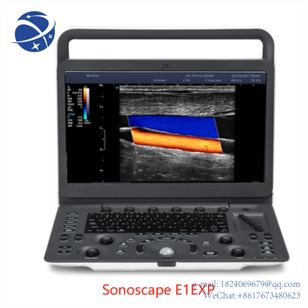 

Sonoscape E1EXP+ microconvex+ linear, （with color Doppler and PW ）