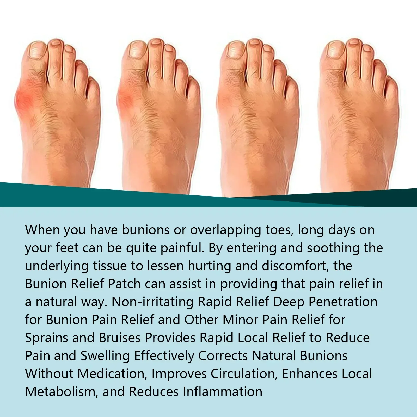 Bunion Pain Relief Patch Feet Bone Thumb Corrector Arthritis Foot Gout Swelling Treatment Medical Plaster Toe Pain Patch 6pcs/bo
