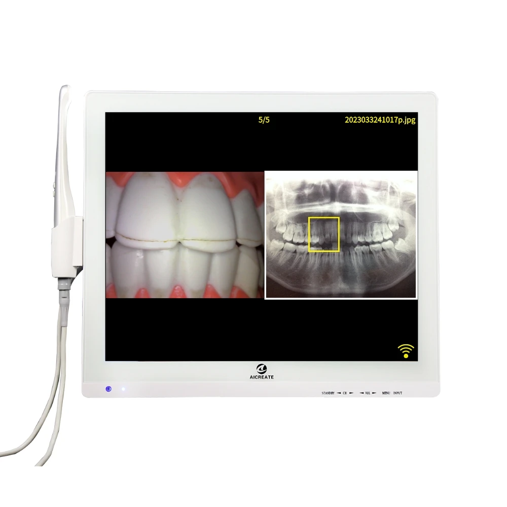 

Hot sale WIFI intraoral with for den tal clinic