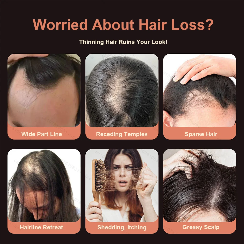 Red Light Therapy Electric Massage Comb Vibration Anti Hair Loss Scalp Brush Hair Oil Applicator for Hair Growth Hair Care