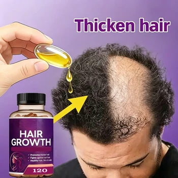 Siero per la ricrescita dei capelli – Nutre i follicoli e penetra nelle radici, trattamento naturale per una regenerazione dei capelli dall'aspetto più folto e denso