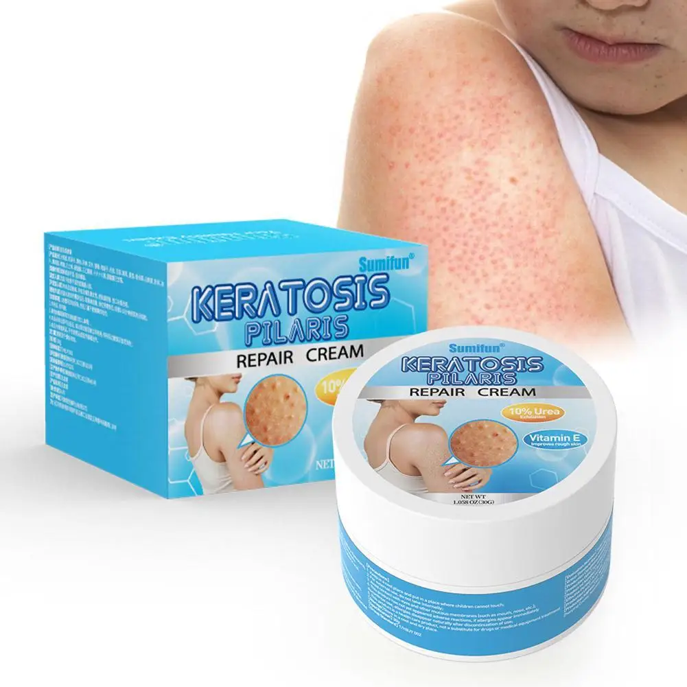 

Vitamin E Strawberry Legs Removal Body Scrub Chicken Skin Cream Urea Exfoliating Pimple Skin Whitening Moisturizer Care 30g