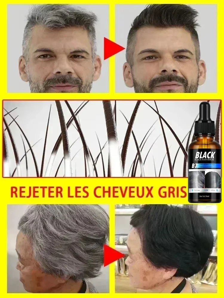 Hair Treatment Turn White Hair into Black Remove Gray Hair in 7 Days