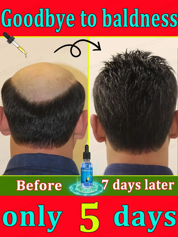 Hair growth essential oil used by celebrities say goodbye to baldness and hair loss in 7 days healthy hair is growing hair growth serum hair growth spray hair growth cream