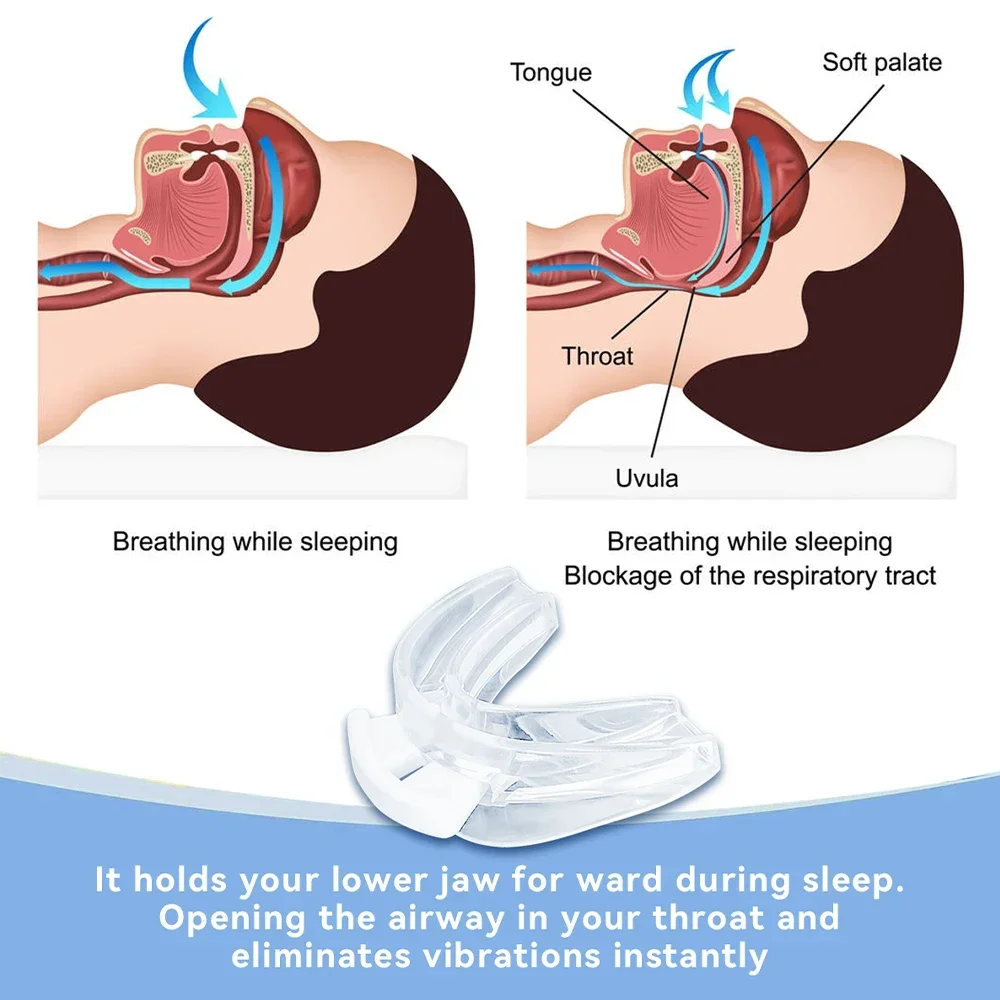 Anti Snoring Bruxism Silicone Mouthpiece & Sleeping Ear Plugs Improve Sleeping Teeth Bruxism Sleep Aid Anti-Snore&Apnea Device