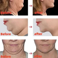 Crème amincissante en forme de V, raffermissante, lifting du visage, élimine le double ruisseau, raffermit les muscles, brûle les graisses mandibulaires, estompe les lignes du cou 3
