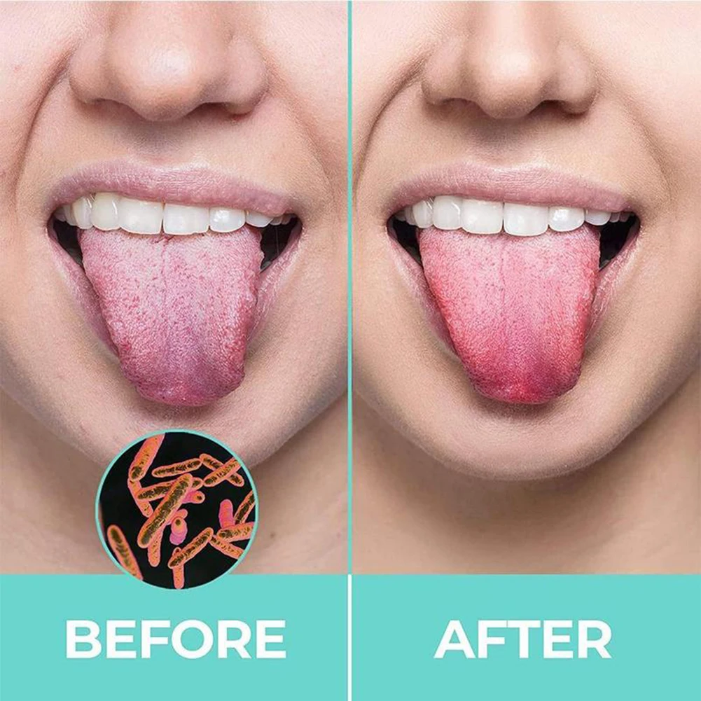 5 Pairs 2 In 1 Tongue Scraper Reusable Oral Hygiene Care Tongue Brush Cleaner Food Grade Mouth Fresh Breath Oral Cleaning Tools