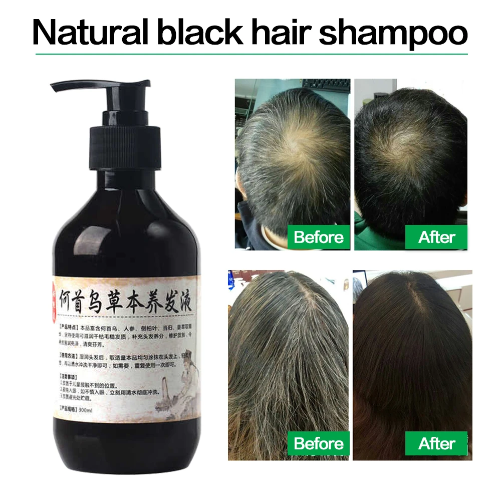 

Sdattor Herbal Natural Polygonum Multiflorum Shampoo Plant Liquid Grey Hair White Hair Removal Turn Permanent Black Hair Care 30