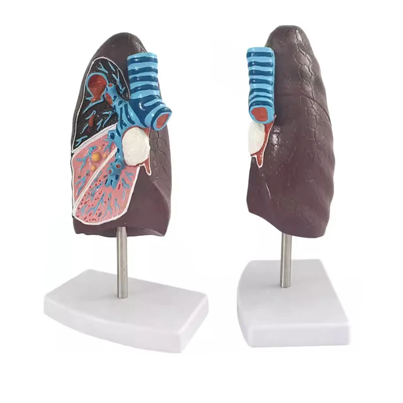 

Human Anatomical Pathological Pulmonary Model Pulmonary Anatomy Respiratory System Model Medical Teaching Equipment