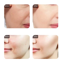 Sérum et crème hydratante pour le visage, éclaircissante, raffermissante, Anti-rides, collagène, pré-essence, Caviar, crème pour les yeux, dissolvant de cernes 5