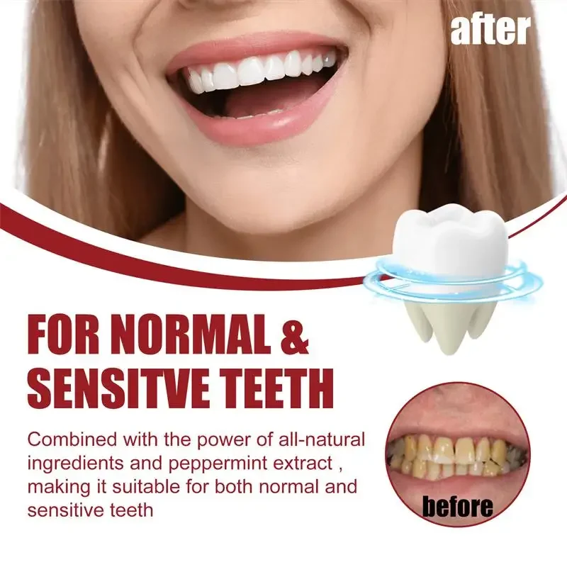 SP-8 Probiotic Toothpaste Whiten Tooth Remove Fresh Breath Clean Mouth Prevent Periodontitis Soft Foam Oral Tooth Care Products teeth whitening product teeth whitening essence teeth health product