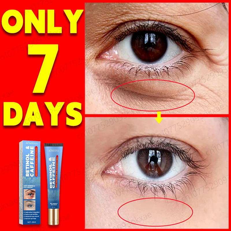 HotAntiWrinkleEyeCreamDarkCirclesRemoveEyeBagsPuffyEyes