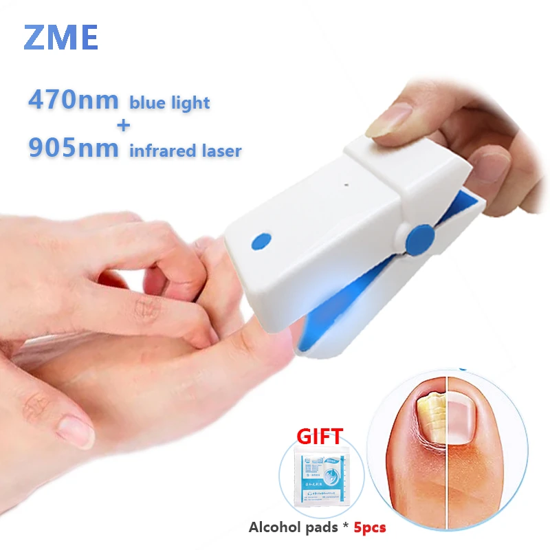 Zme Nail Fungus Laser Device Nail Fungus Treatment Onychomycosis