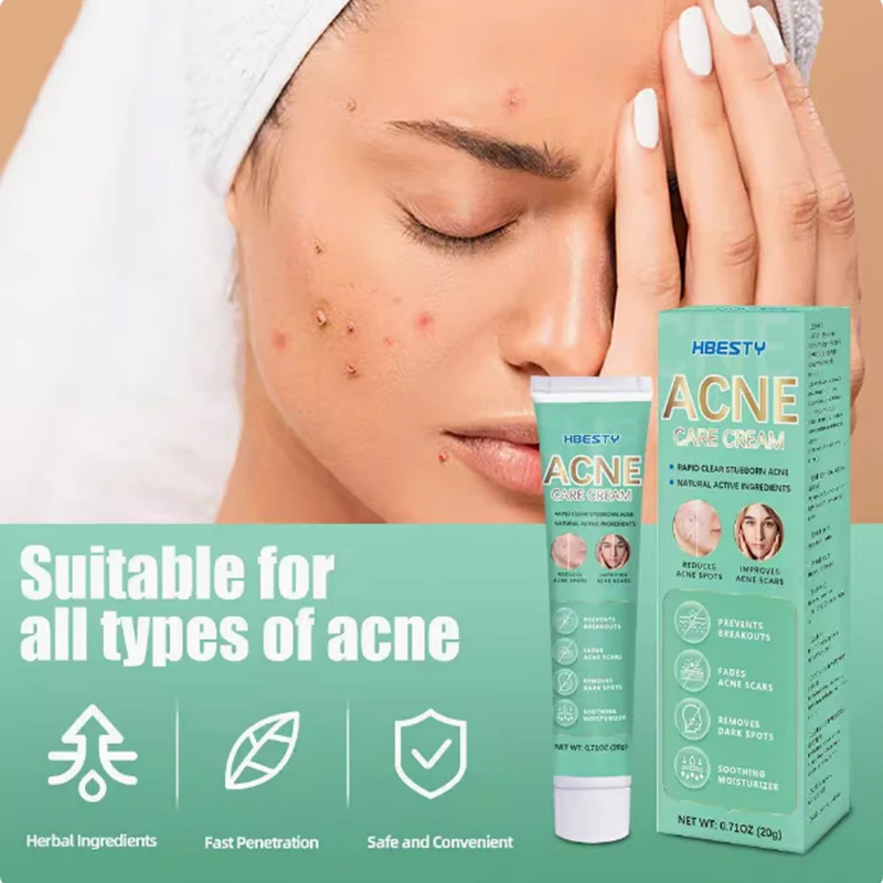 2-10 boxes new product acne care cream repair scars brighten the skin resist external infections directly sold acne care cream 3