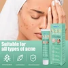 2-10 boxes new product acne care cream repair scars brighten the skin resist external infections directly sold acne care cream 3