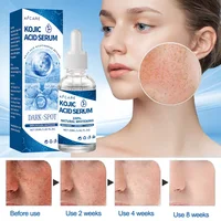 Dark Spot Remover Kojic Acid Serum Sun Spot Freckles Melasma Brown Spot Whitening Moisturizing Facial Glowing Skin Care Beauty 2
