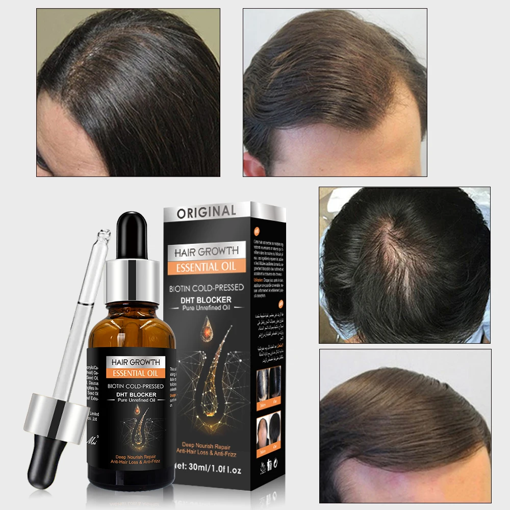 

Ginger Treatment Hair Growth Serum Anti Hair Loss Essential Oil Deep Nourish Repair Prevent Hair Thinning Dry Frizzy Essence