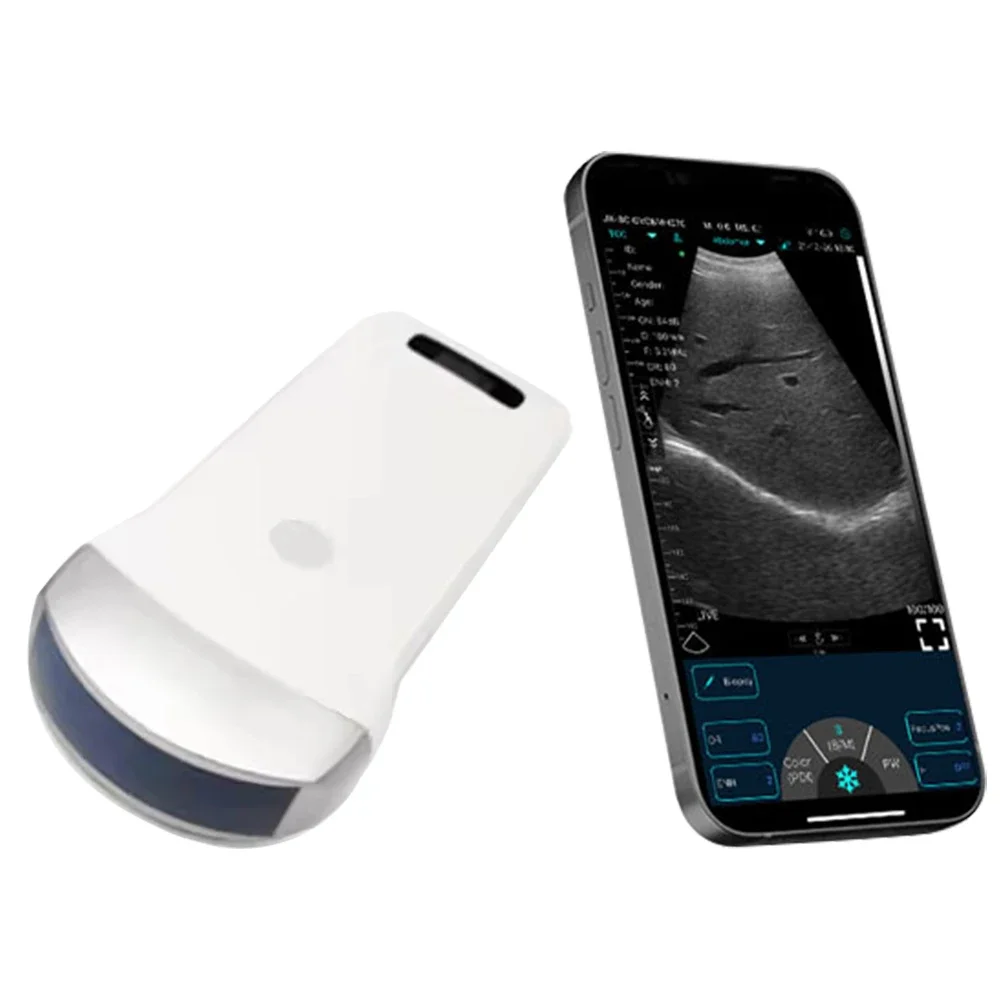 Portable Wireless Ultrasound Convex Probe Scanner Machine Aluminium Box Support IOS Android Windows