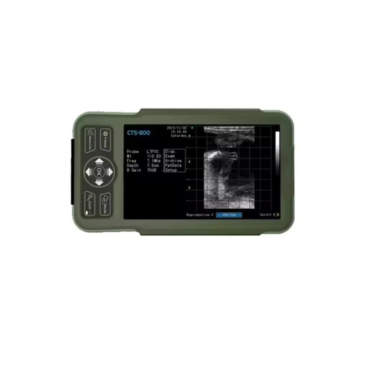 휴대용 소 초음파 스캐너 가축 검사 장치 소 초음파 스캐너 SIUI CTS-800