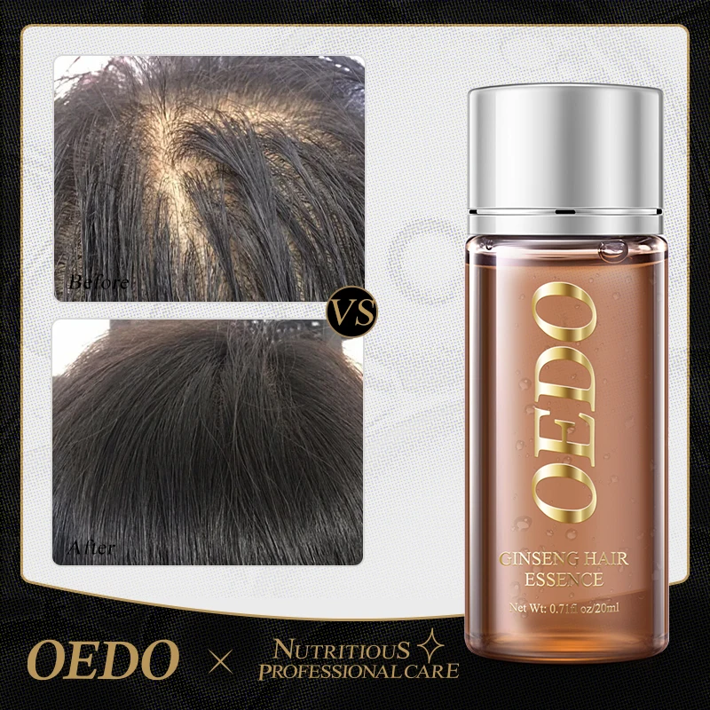 Hair Treatment Oil Ginseng Improve Hair Quality Anti-Hair Loss
