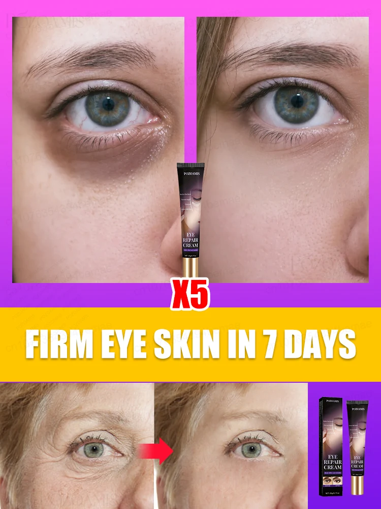 The most effective eye cream eliminates wrinkles eye bags dark circles tightens skin brightens skin in 7 days beauty enhancement product