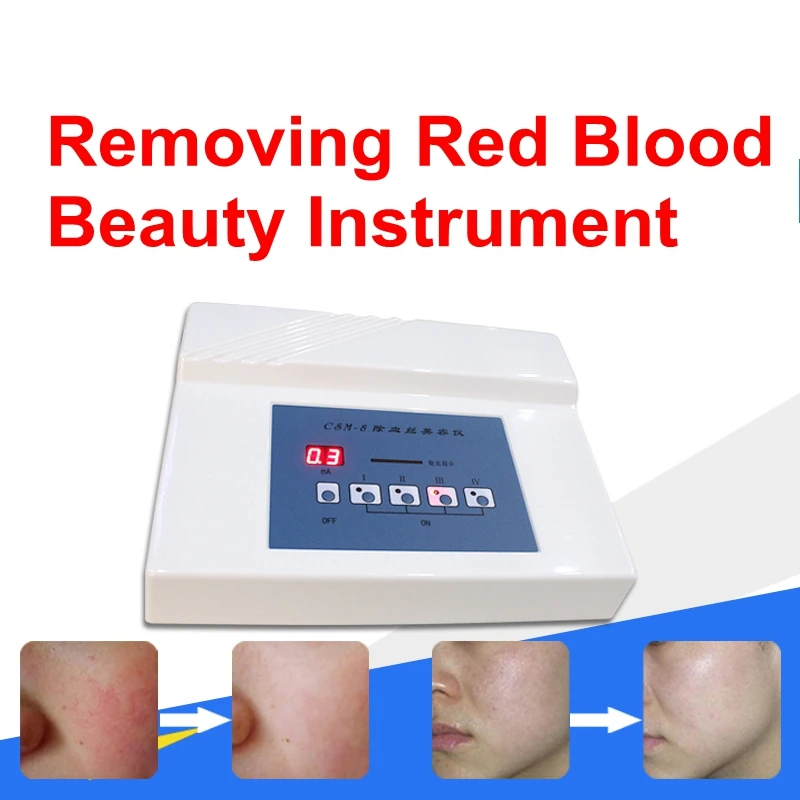 Red Blood Vessel Spots Vascular Removal Beauty Equipment Needle RF Spider Veins Removal Anti Redness Machine parts