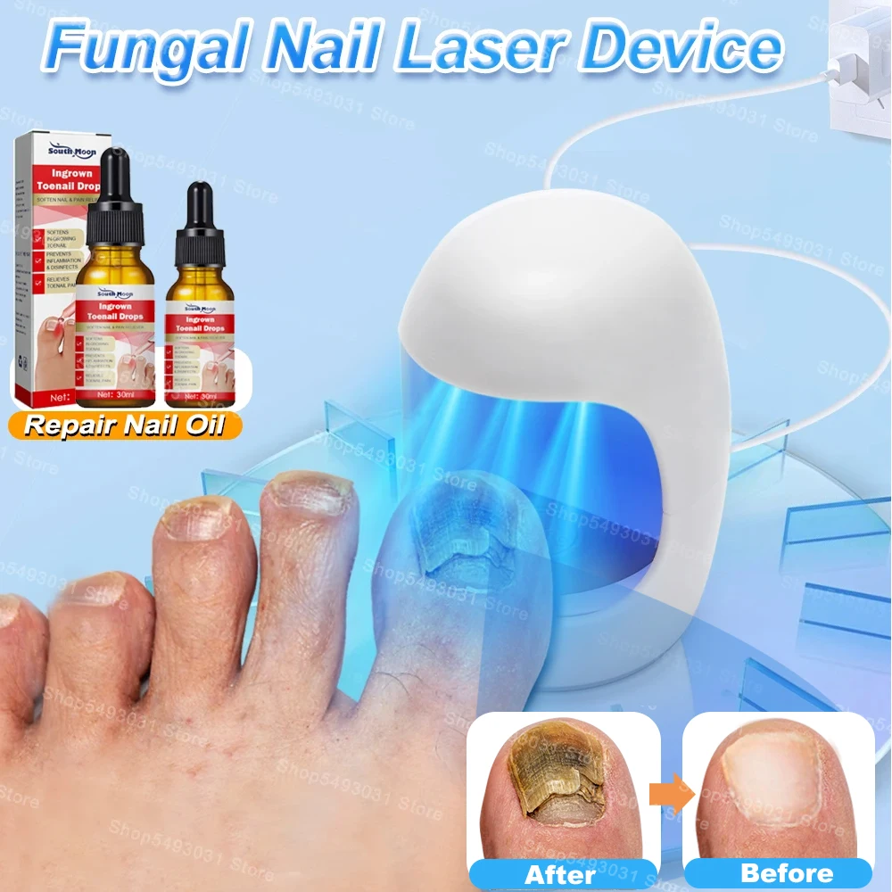 Nail Fungus Laser Treatment Device Fungal Treatment Toenail Feet Care