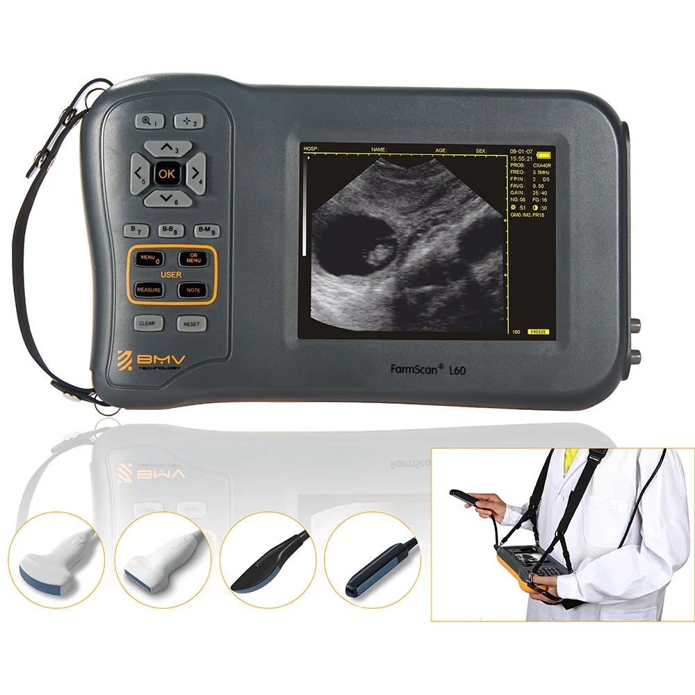 

5.8 Inch Farm Portable Ultrasound Scanner Machine Sheep Pig Cow Equine Pregnancy Veterinary Equipment Farmscan L60 USG Ecografo