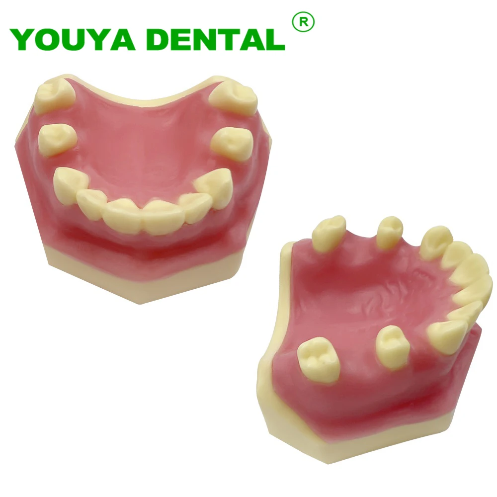 

Dental Implant Teeth Model Practice Demo Typodont For Dentist Student Studying Teaching Models Dentistry Laboratory Products