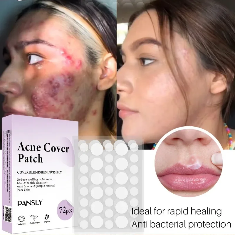 

Invisible Acne Pimple Patch Face Mask Acne Pimple Blemish Removal Stickers Acne Treatment Master Daily / Night Use Skin Care
